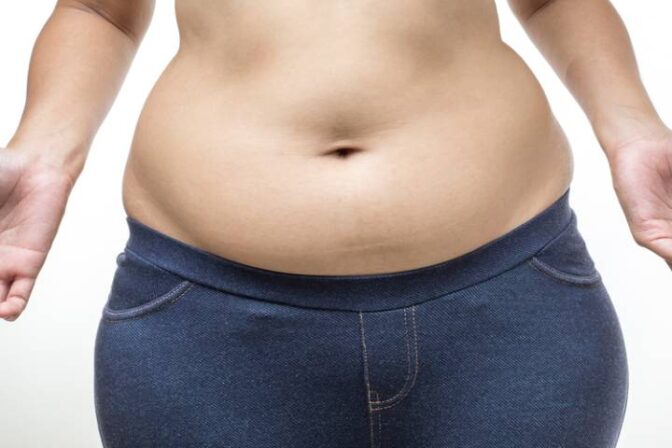 Can PCOS Cause Weight Gain